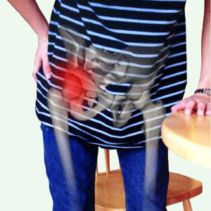 Hip pain stock photo physical therapy~mv2.gif
